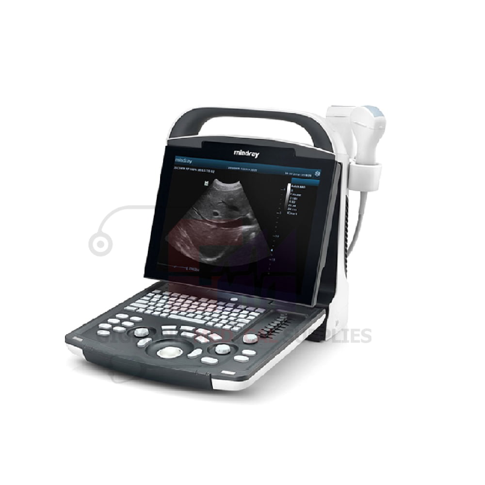 ULTRASOUND SCAN MACHINE DP