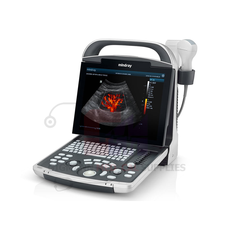 ULTRASOUND SCAN MACHINE DP